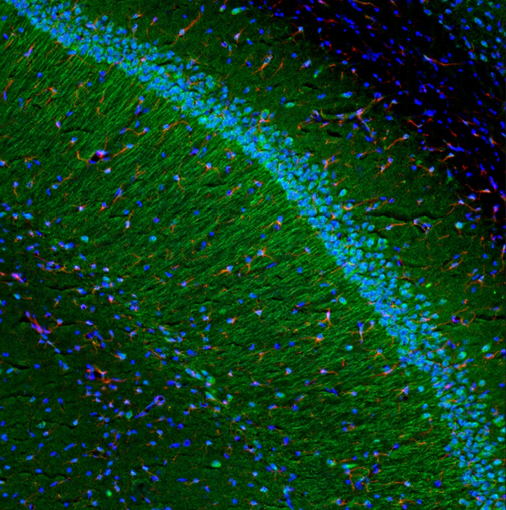 Tnf Antibody