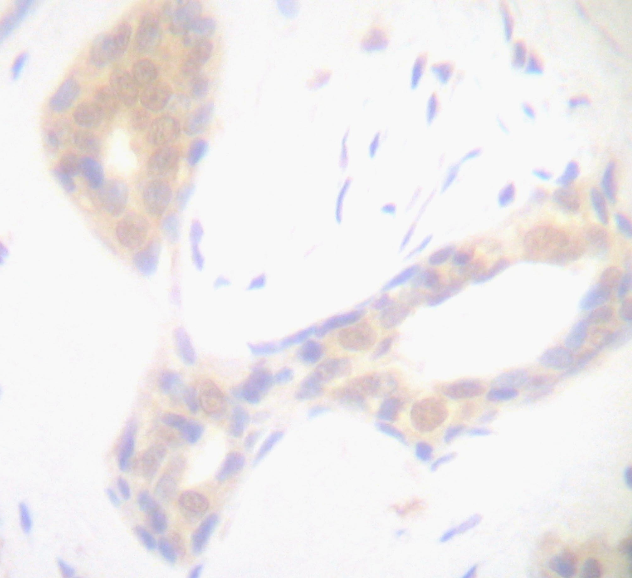 TNF Antibody