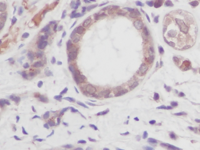 TNF Antibody