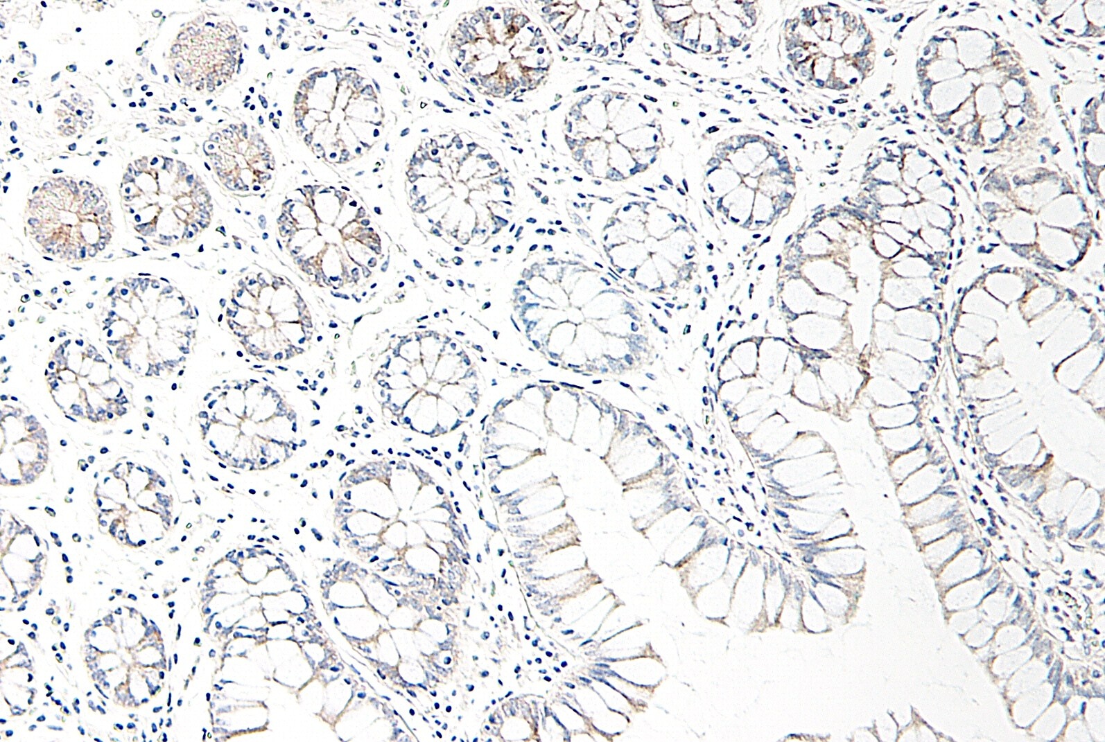 CCL25 Antibody