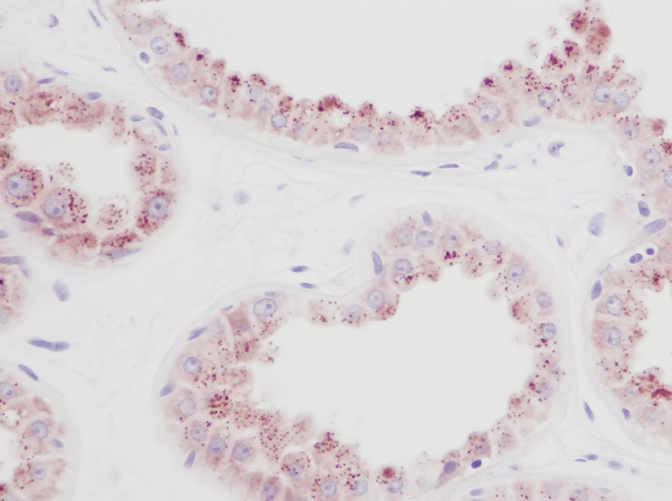 PDGFB Antibody