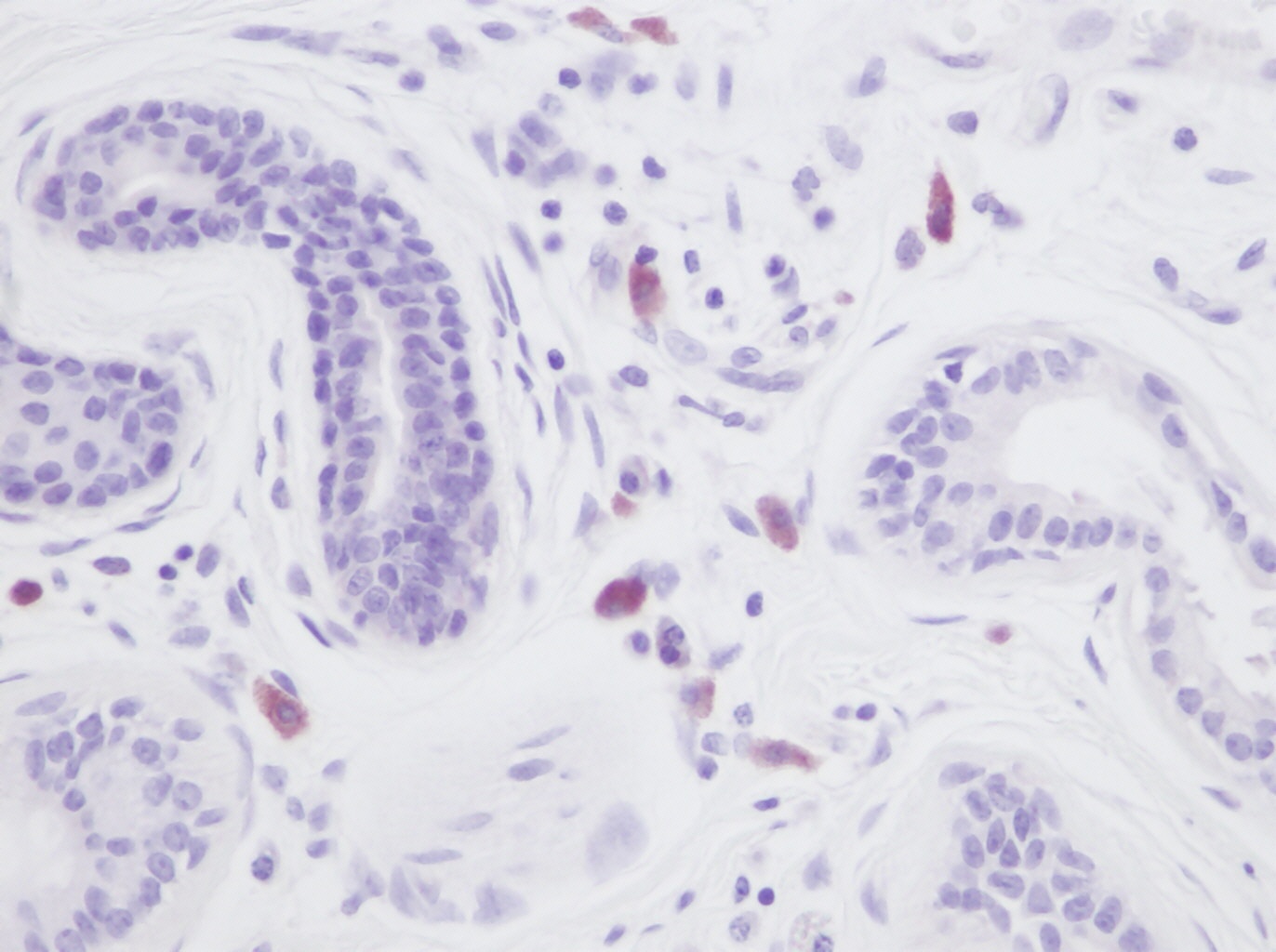 IL8 Antibody