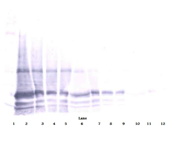 Il6 Antibody
