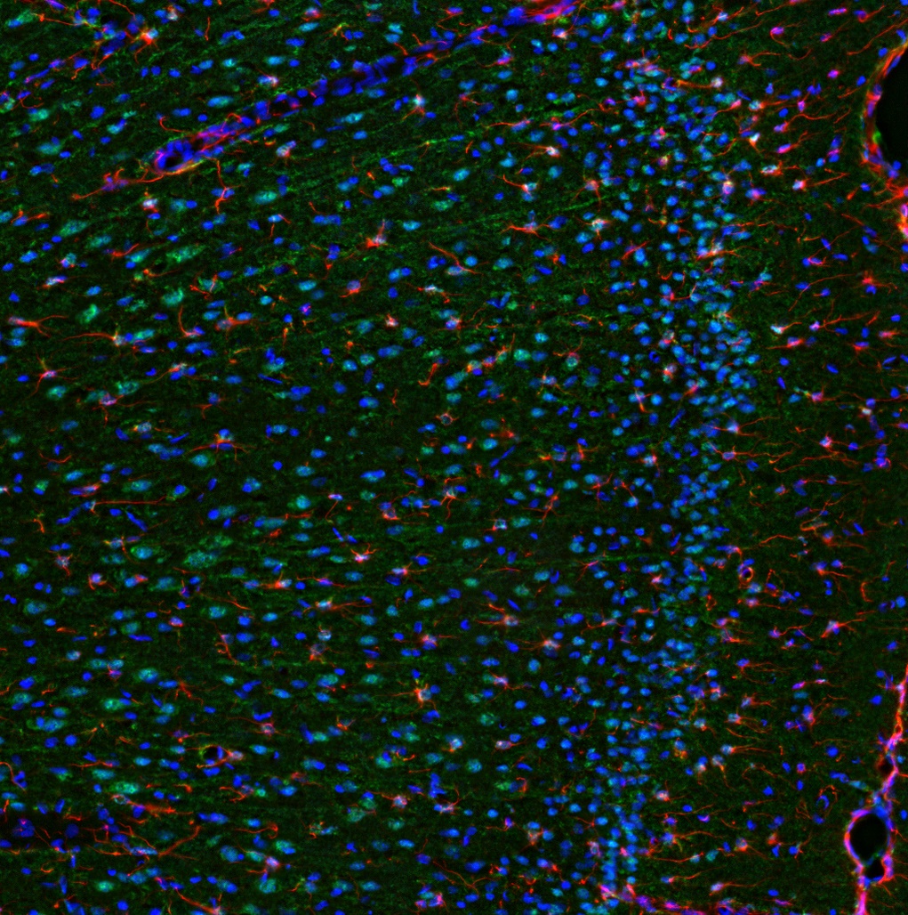 Il6 Antibody