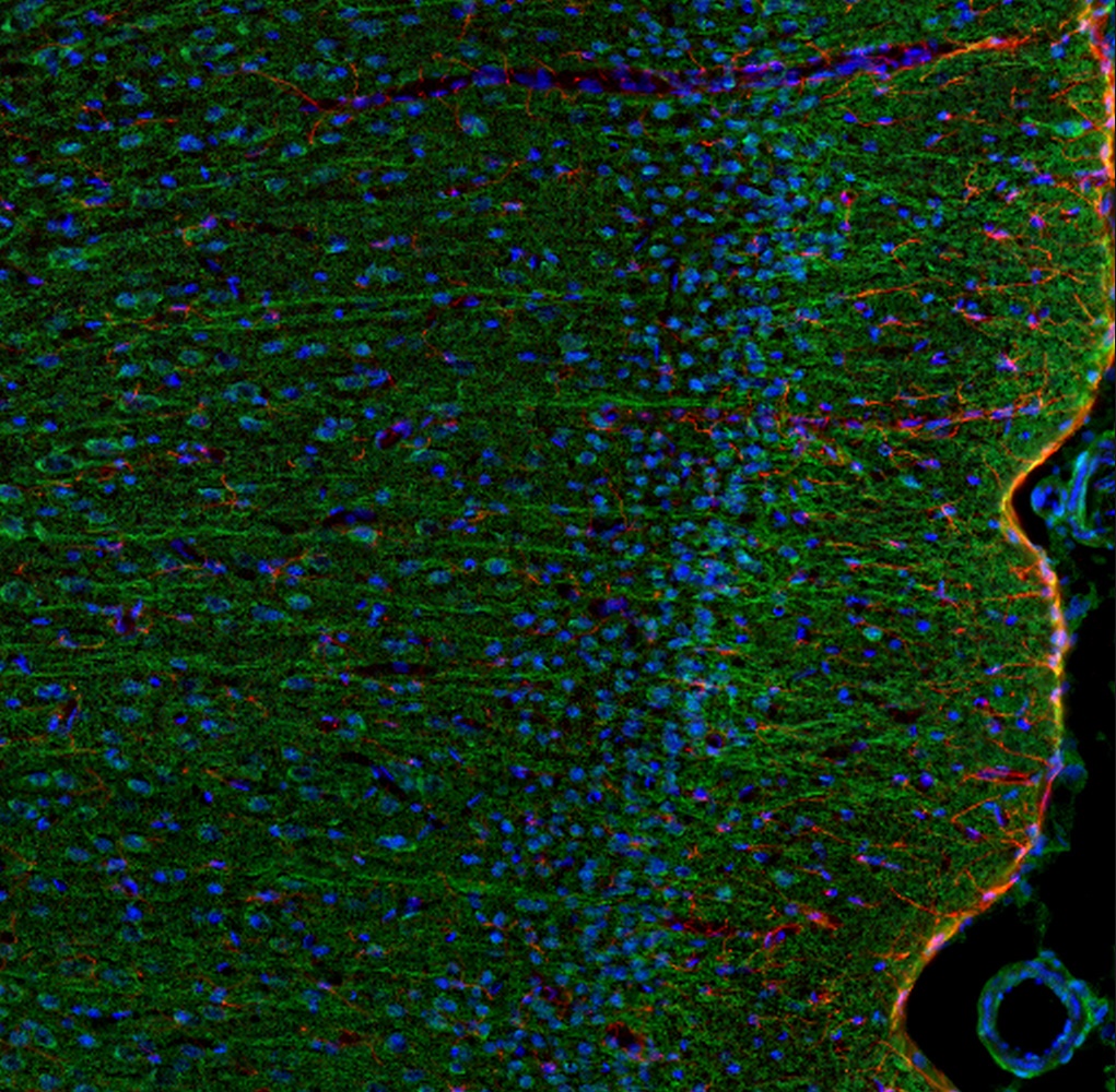Il6 Antibody