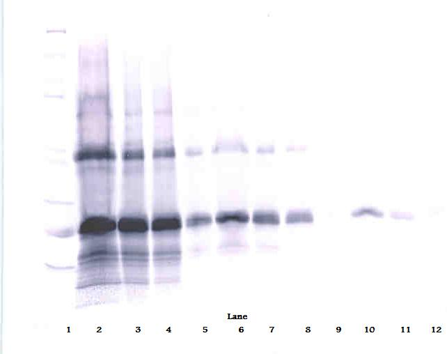 Il6 Antibody