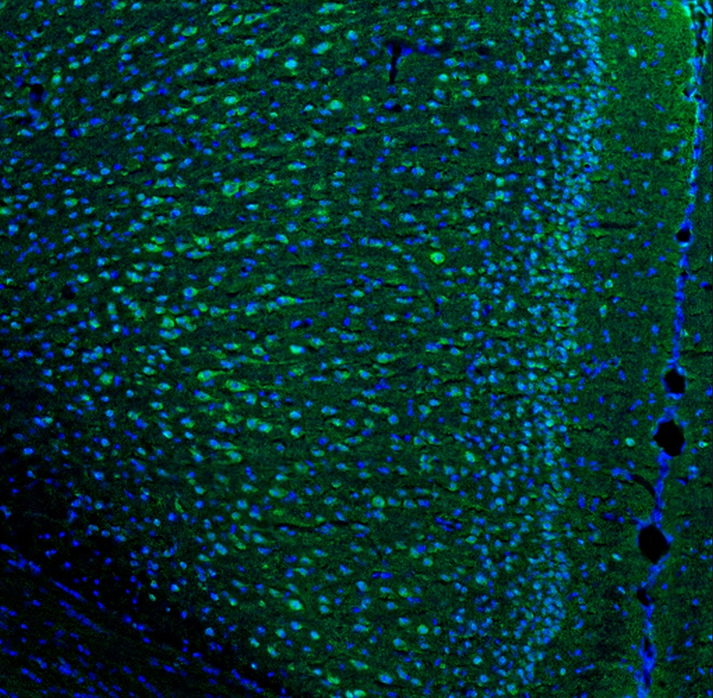 Il6 Antibody