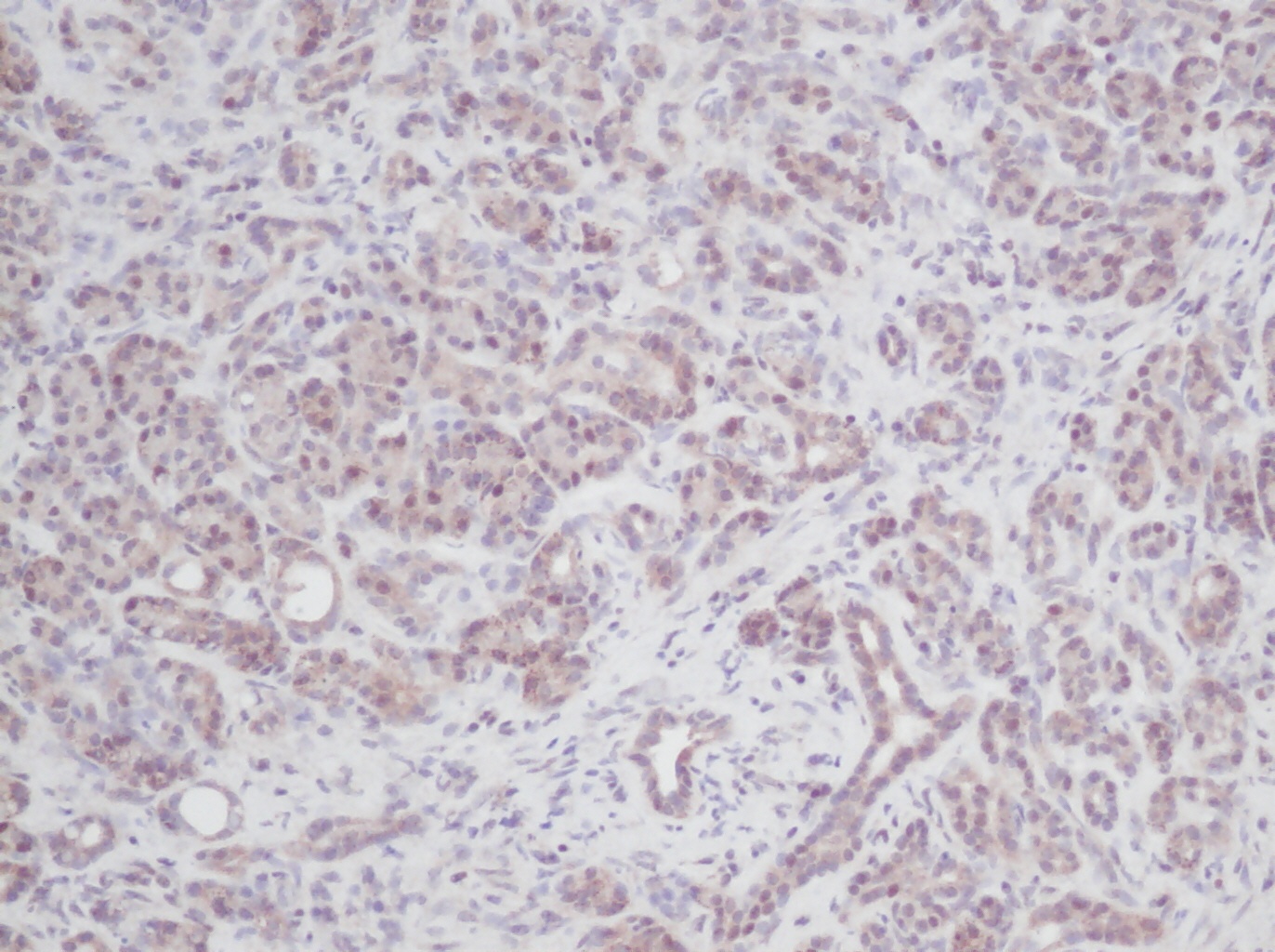 IL2 Antibody
