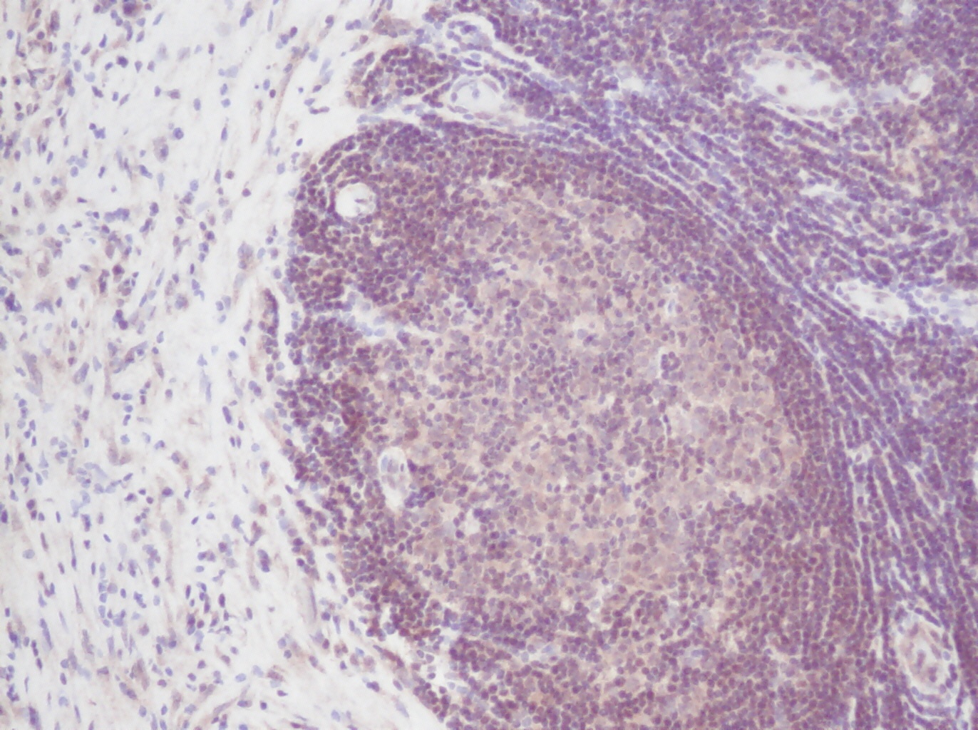 IL2 Antibody