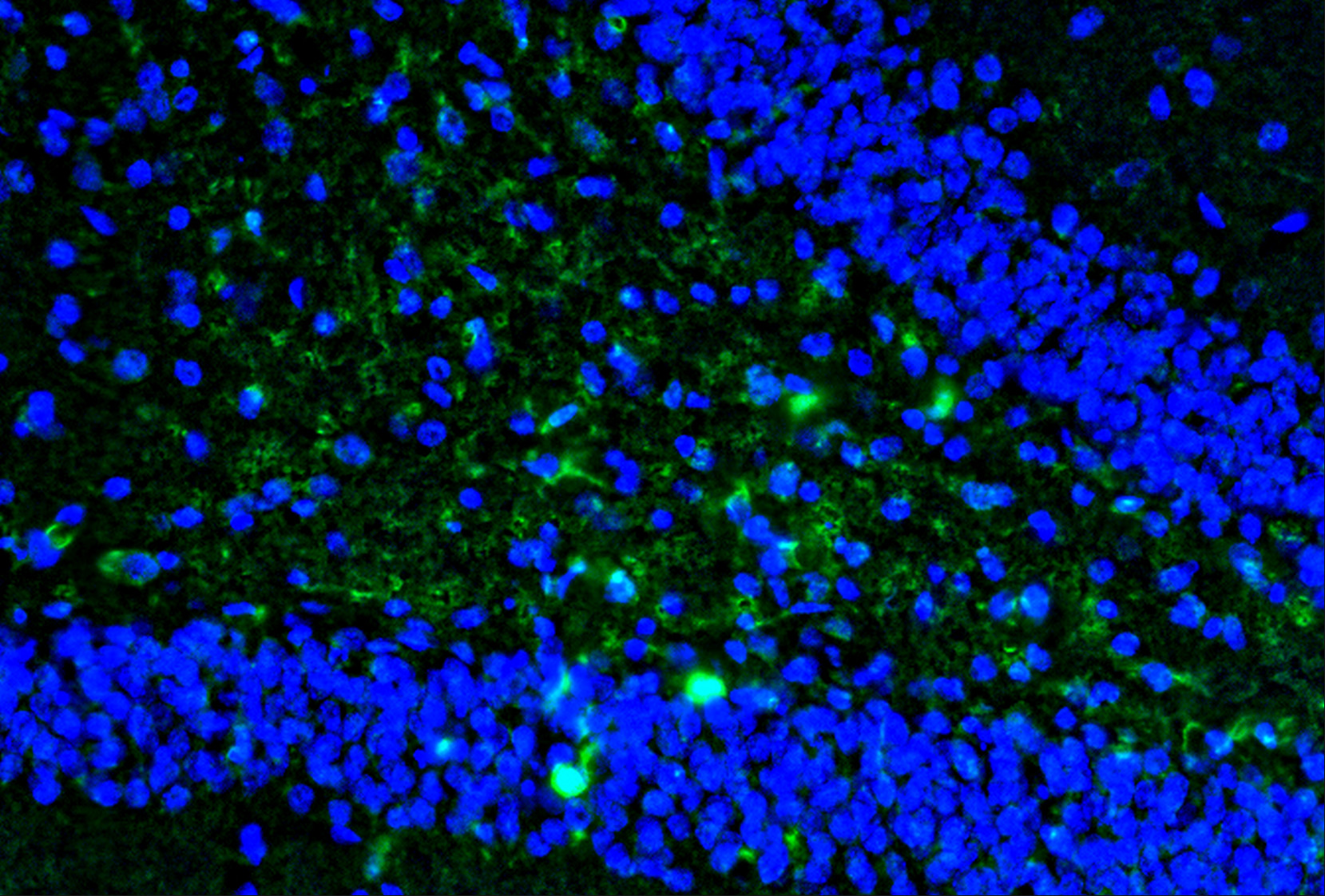 Il1b Antibody