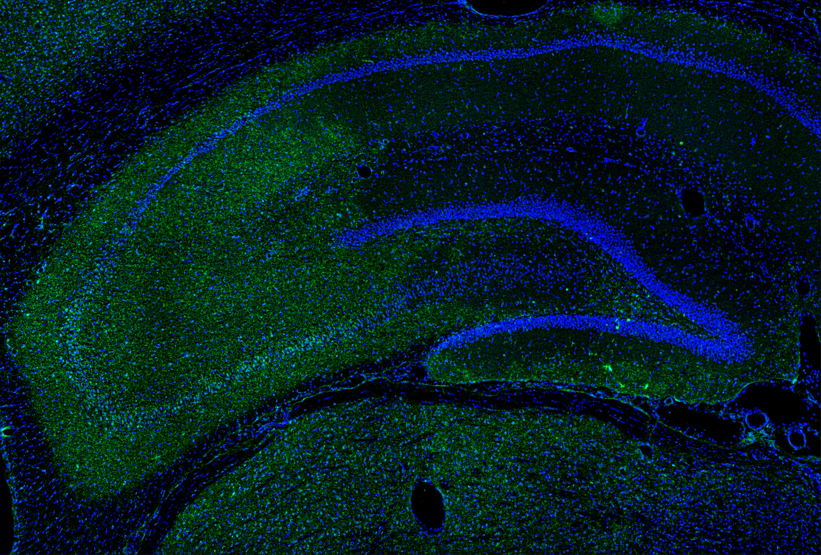 Il1b Antibody