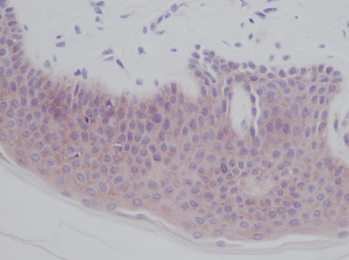 IL1A Antibody