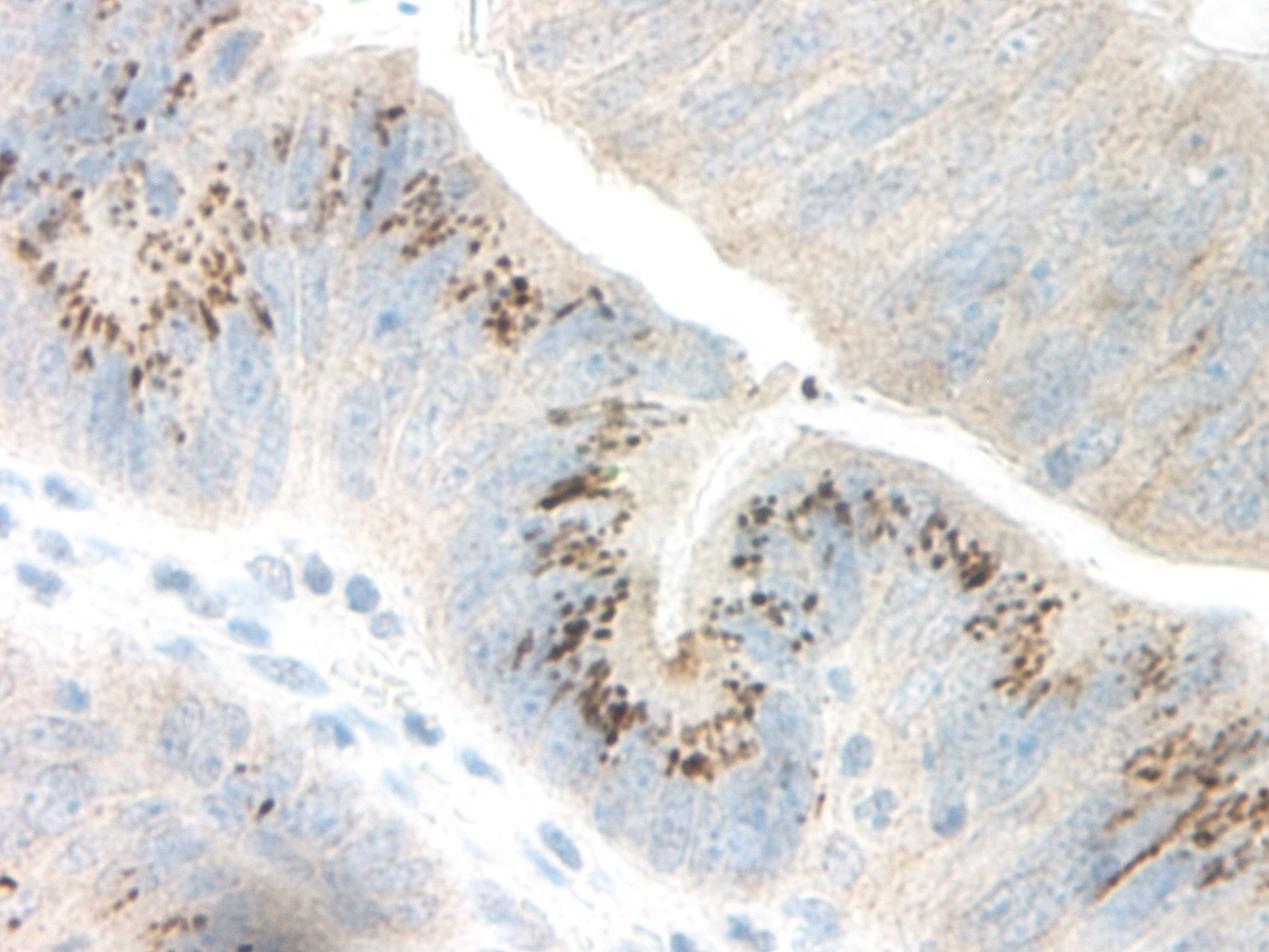 CXCL3 Antibody