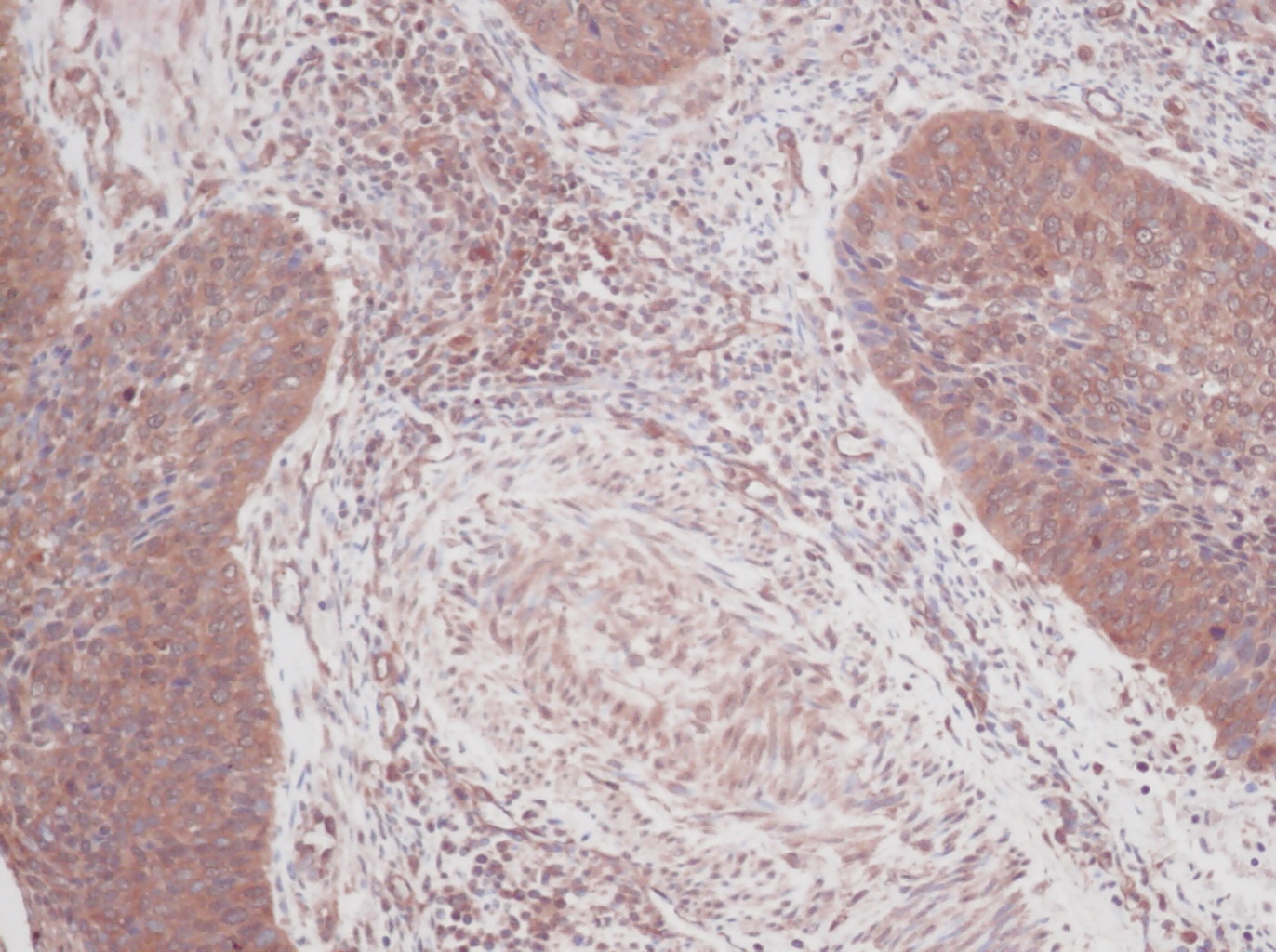 CSF2 Antibody