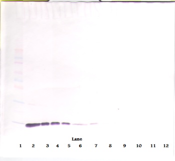 IL2 Antibody