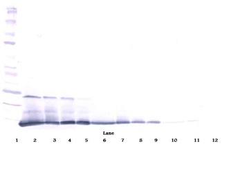 Il5 Antibody
