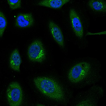 CCL27 Antibody