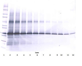IGFBP3 Antibody