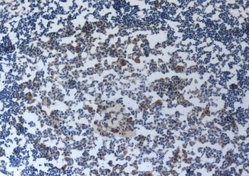 IL2RA Antibody