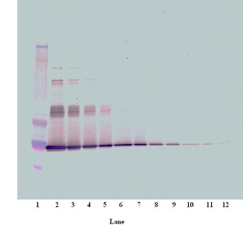 IL6 Antibody