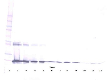 IL6 Antibody
