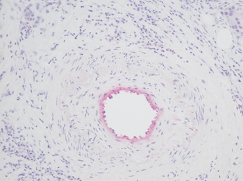 COL18A1 Antibody