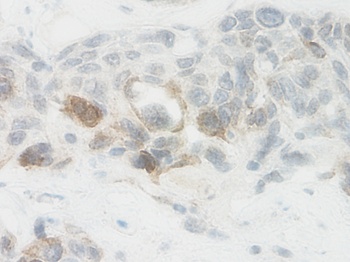 NOV Antibody