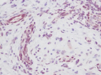 MIA Antibody
