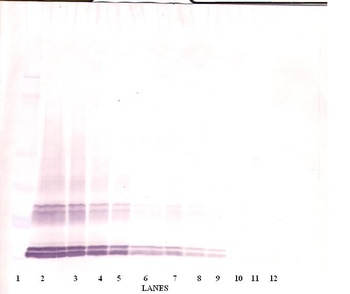 GDF3 Antibody