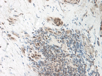 GDF3 Antibody