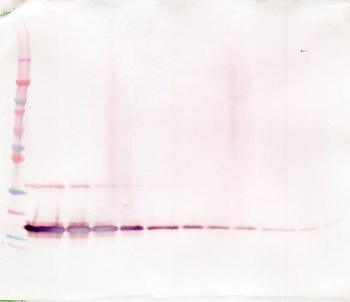 TNFRSF1B Antibody