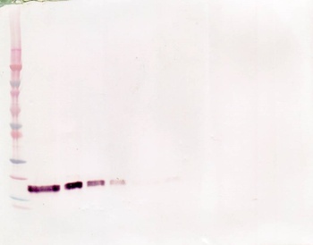 TNFRSF1B Antibody