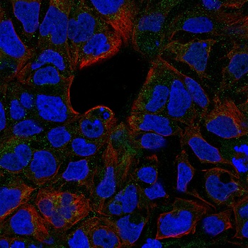 TNFRSF1B Antibody