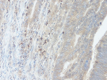 RETNLB Antibody