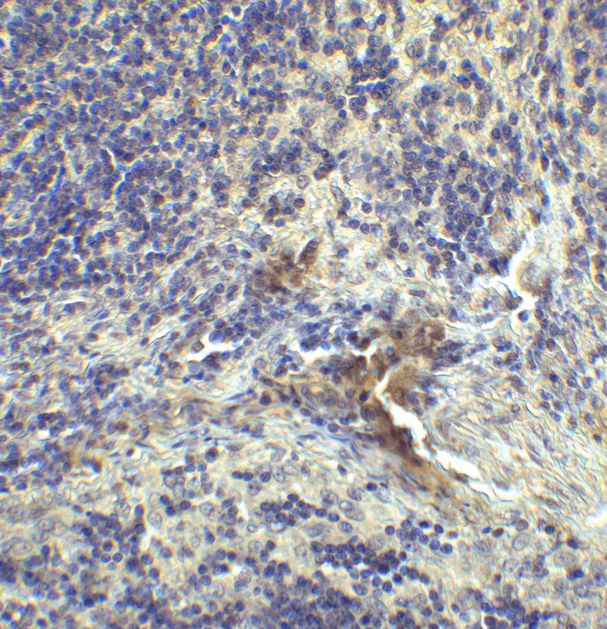 LAG3 Antibody