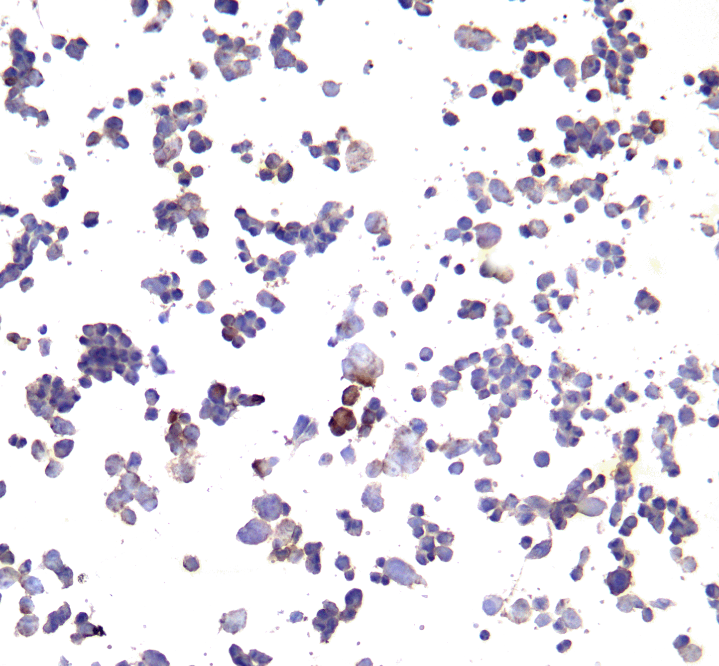 CD274 Antibody