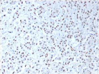 WT1 Antibody