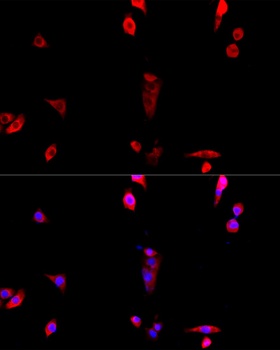 BAZ1B Antibody