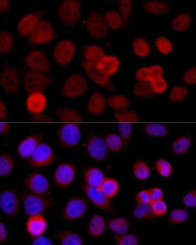 BAZ1B Antibody