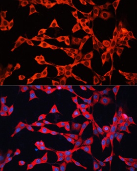 GDI2 Antibody
