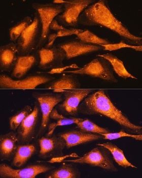 PFKP Antibody