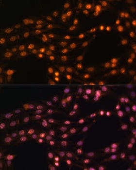 SUZ12 Antibody