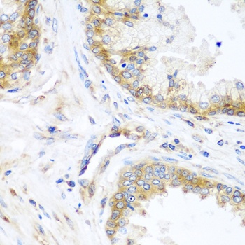 YBX1 Antibody