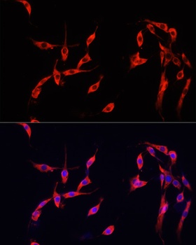SMAD2 Antibody