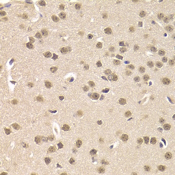 CSNK1E Antibody
