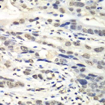 NUDT1 Antibody