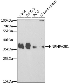 HNRNPA2B1 Antibody