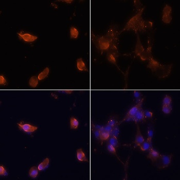 MAP1LC3A/MAP1LC3B Antibody