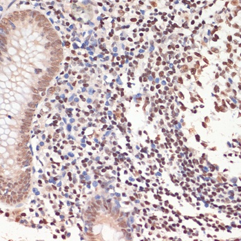PARP1 Antibody
