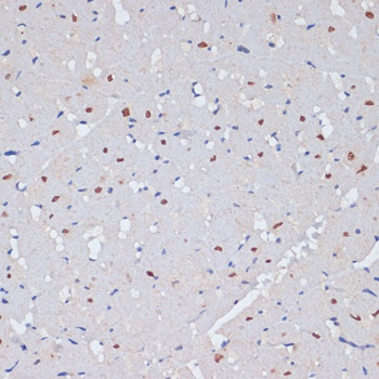 PARP1 Antibody